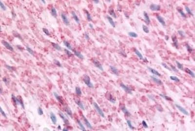 Immunohistochemistry-Paraffin: alpha-2C Adrenergic R/ADRA2C Antibody [NBP3-14537]